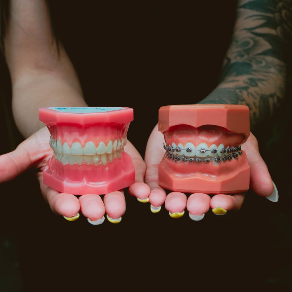 A dentist hols up an example of a mouth with Invisalign clear aligners in, and a set of teeth with traditional braces.