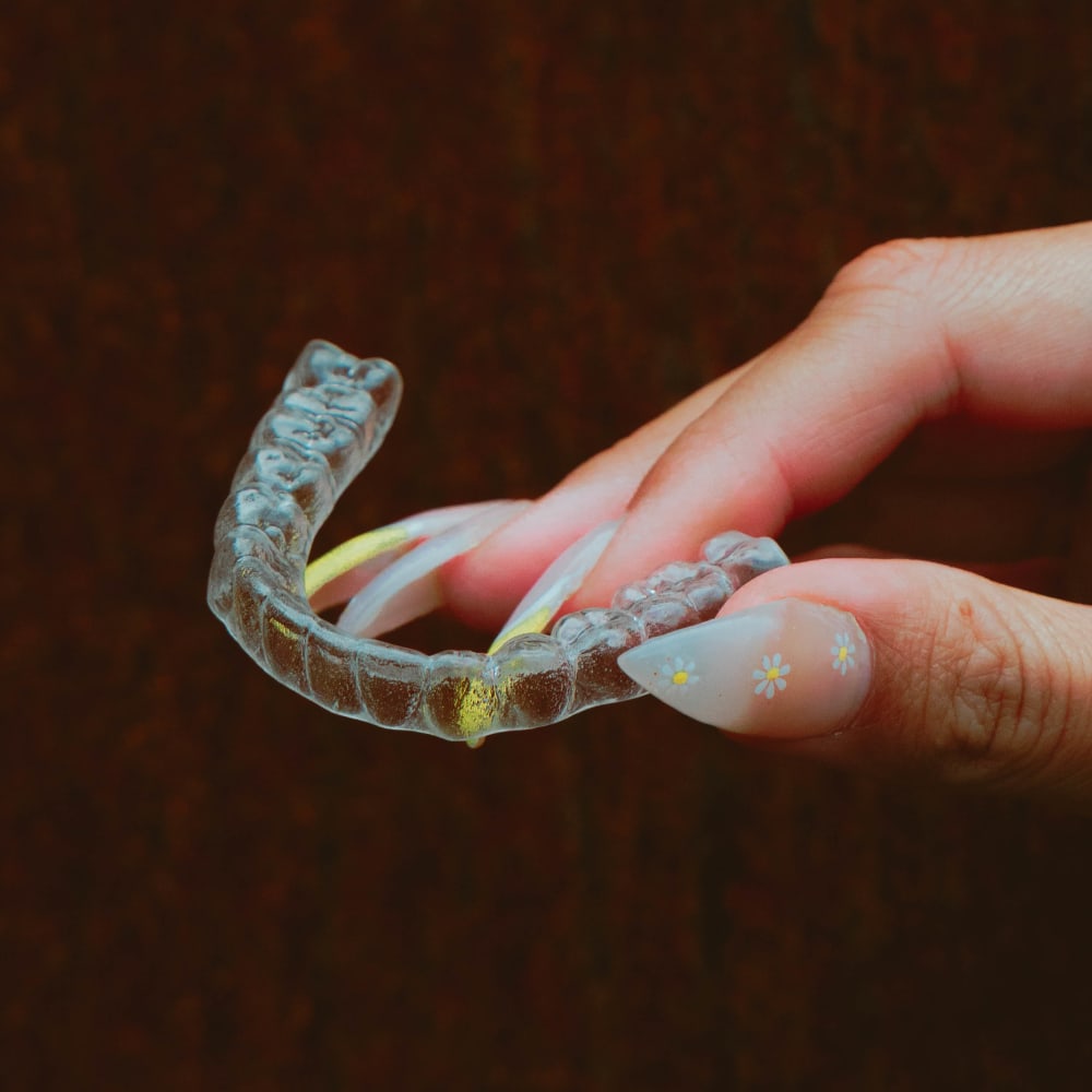 A woman puts on her Invisalign clear aligners.